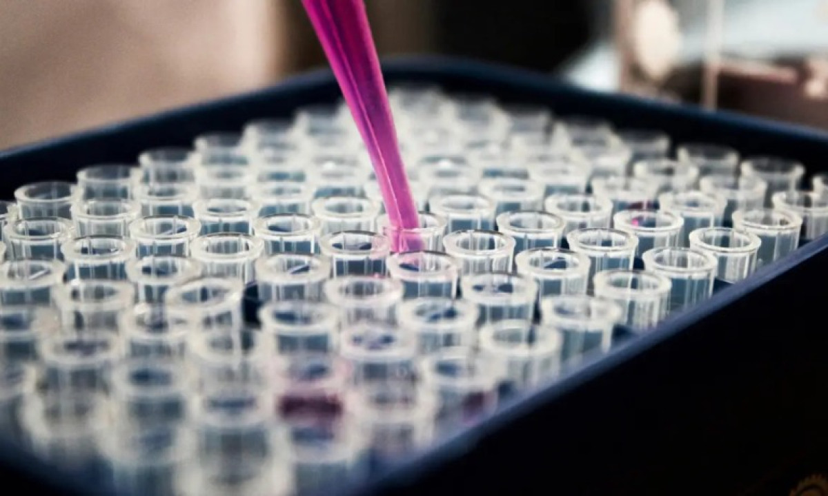 Leia mais sobre o artigo Entenda o exame de sangue que detecta sinais de câncer antes da tomografia